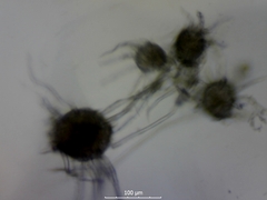 Podosphaera epilobii