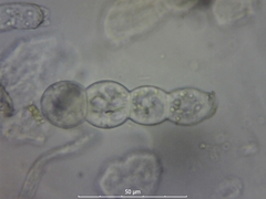 Podosphaera epilobii