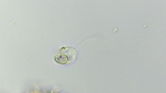 Protozoa