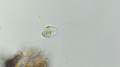Protozoa