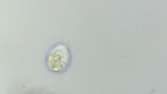 Protozoa