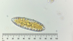 Surirella