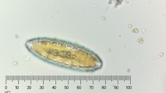 Surirella