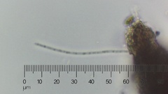 Bacteria