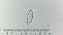 Bacillariophyceae