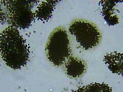 Microcystis