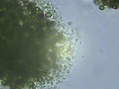 Microcystis