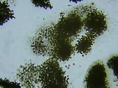 Microcystis