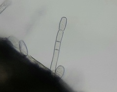 Golovinomyces cichoracearum