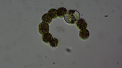 Dolichospermum