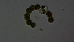Dolichospermum