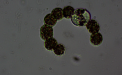 Dolichospermum