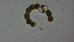 Dolichospermum