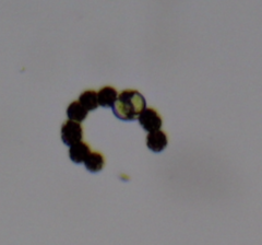 Dolichospermum