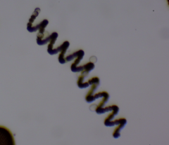 Dolichospermum