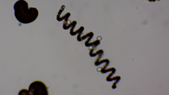 Dolichospermum