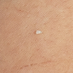 Aleyrodes proletella