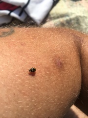 Propylea quatuordecimpunctata