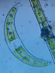Closterium leibleinii