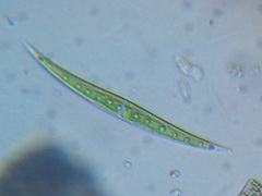 Closterium ralfsii
