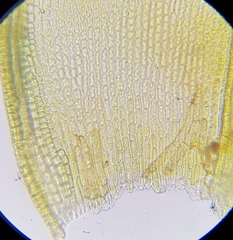 Didymodon icmadophilus