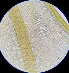 Didymodon icmadophilus