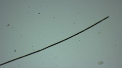 Dolichospermum