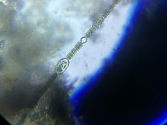 Dolichospermum