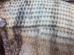 Diplodus