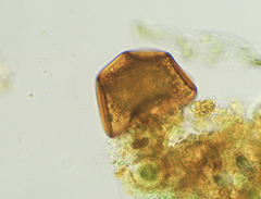 Arcella conica