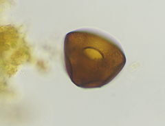 Arcella costata