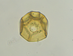 Arcella costata