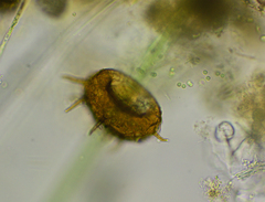 Centropyxis discoides