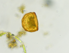 Arcella gibbosa