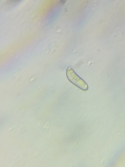 Boletus miniato-olivaceus