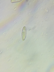 Boletus miniato-olivaceus