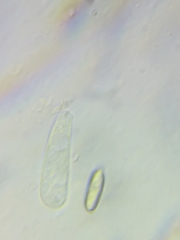 Boletus miniato-olivaceus