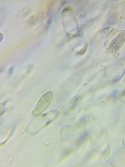 Boletus miniato-olivaceus