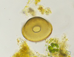 Arcella vulgaris
