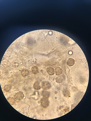 Thelephora cuticularis