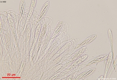 Coccomyces tumidus