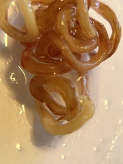 Eustrongylides ignotus