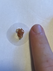 Eustrongylides ignotus