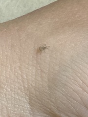 Cheiracanthium mildei