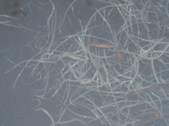 Enchytraeidae