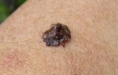 Mollusca