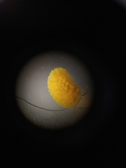 Onchidoris muricata