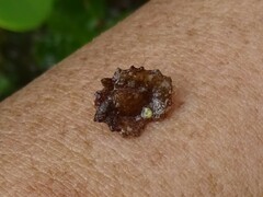 Mollusca