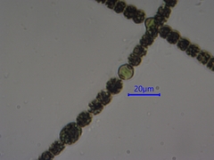 Dolichospermum