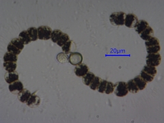 Dolichospermum